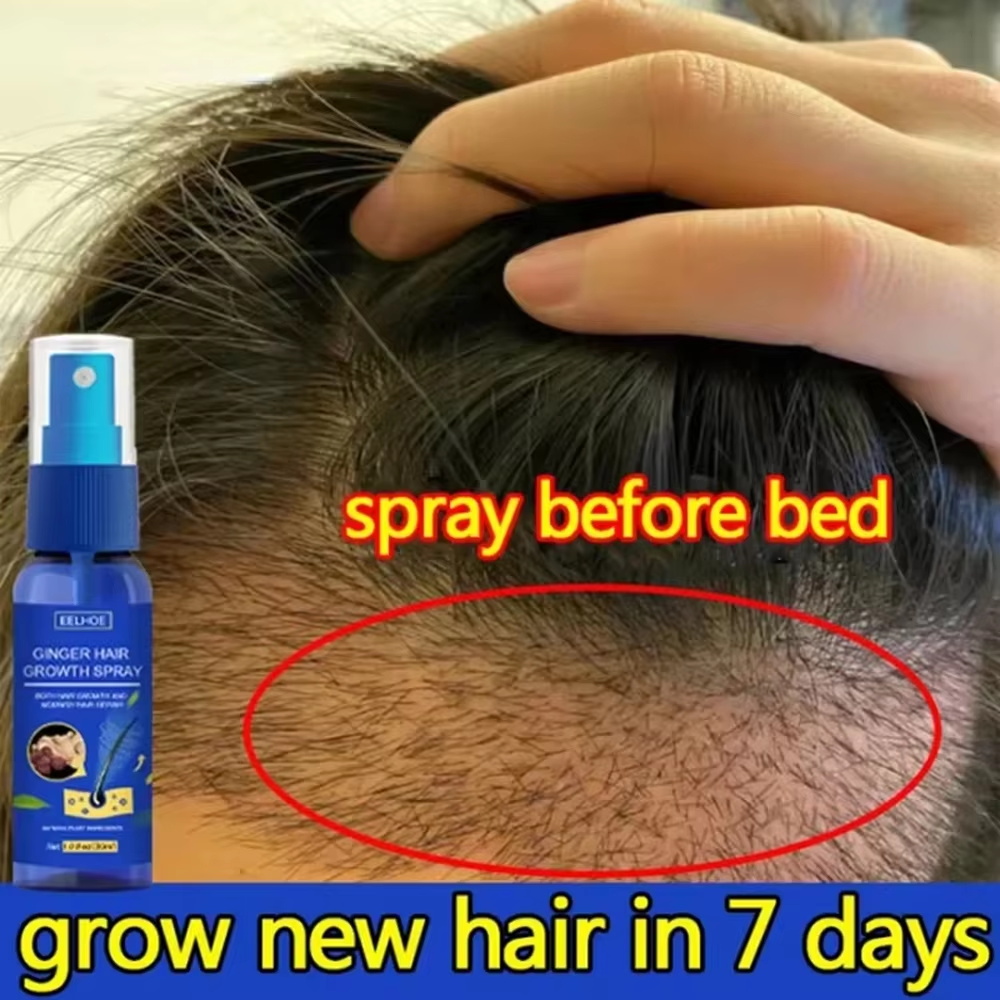 Hair Care Growth - Fast Ginger Hair Growth Spray Roots